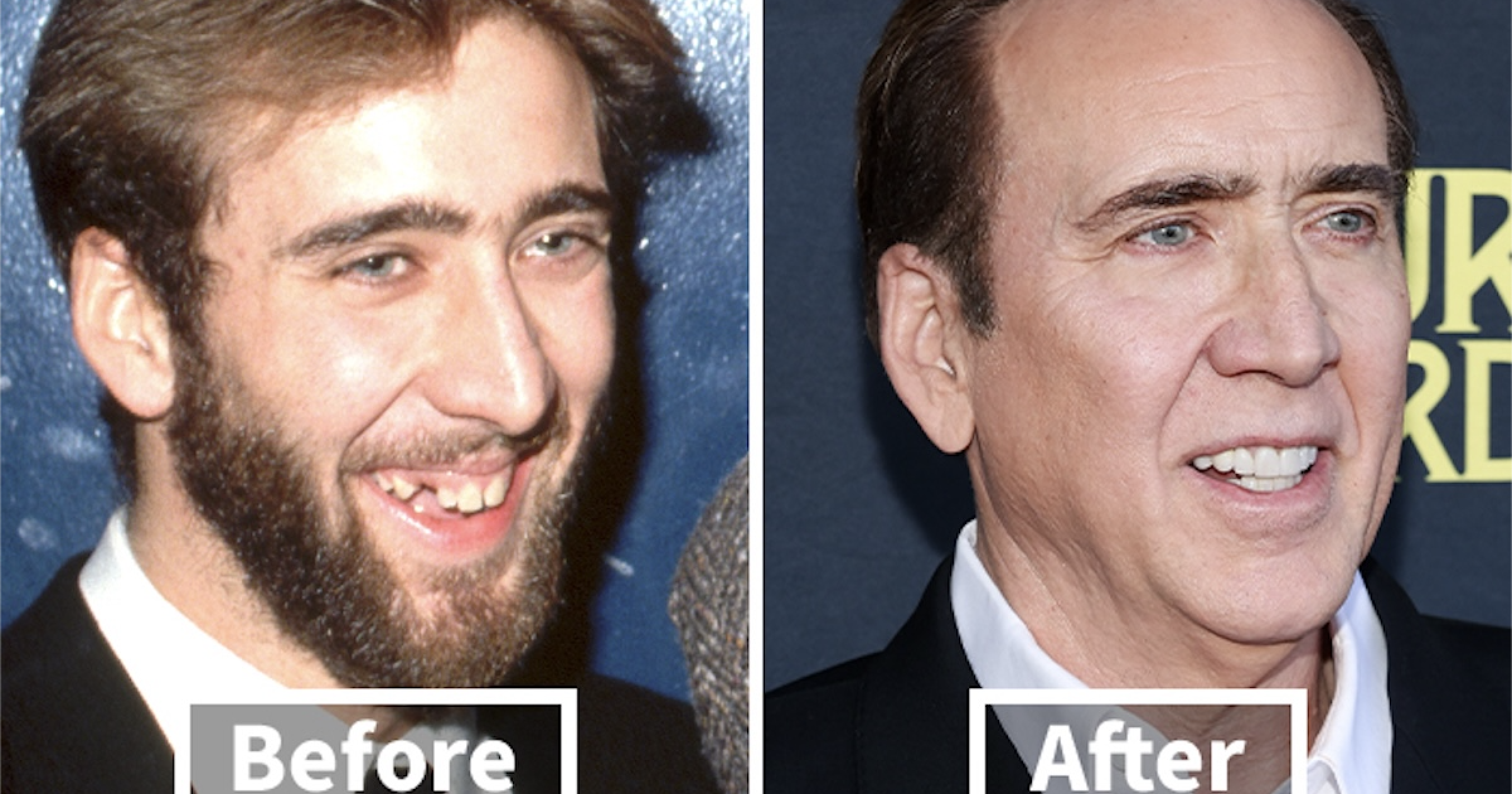 Transformations Unveiled: 14 Celebrities Before and After Their Dentist Visits